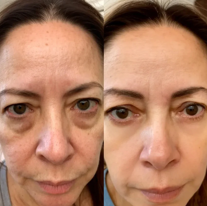 Revitalizador de ojeras® 2 en 1: Terapia de Luz Roja + EMS para Eliminar las Bolsas de los Ojos