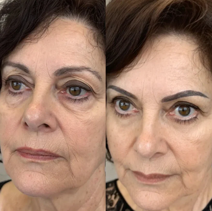 Revitalizador de ojeras® 2 en 1: Terapia de Luz Roja + EMS para Eliminar las Bolsas de los Ojos