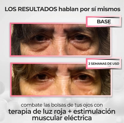 Revitalizador de ojeras® 2 en 1: Terapia de Luz Roja + EMS para Eliminar las Bolsas de los Ojos